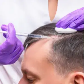 PRP For Hair Restoration